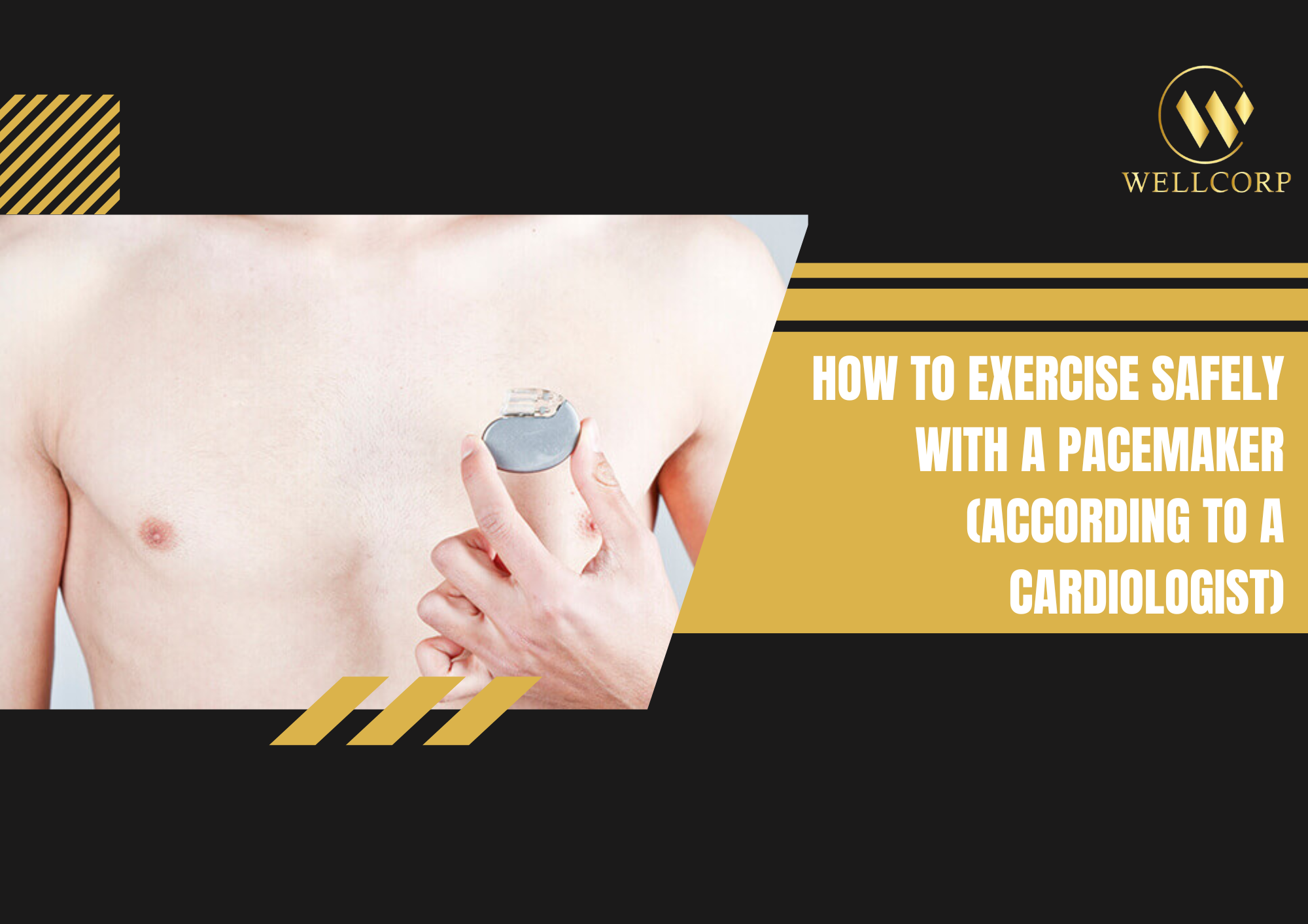 How to Exercise Safely With a Pacemaker, According to a Cardiologist